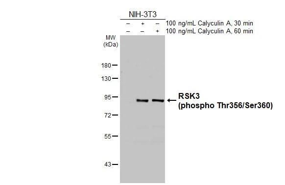 Untreated (–) and treated (+) NIH-3T3 whole cell extract (30 μg) were separated by 7.5% SDS-PAGE, and the membrane was blotted with RSK3 (phospho Thr356/Ser360) antibody [HL3299] (GTX640988) diluted at 1:2000. The HRP-conjugated anti-rabbit IgG antibody (GTX213110-01) was used to detect the primary antibody.