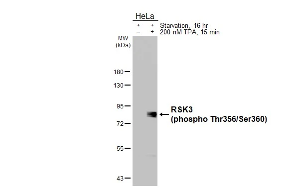 Untreated (–) and treated (+) HeLa whole cell extracts (30 μg) were separated by 7.5% SDS-PAGE, and the membrane was blotted with RSK3 (phospho Thr356/Ser360) antibody [HL3299] (GTX640988) diluted at 1:2000. The HRP-conjugated anti-rabbit IgG antibody (GTX213110-01) was used to detect the primary antibody.