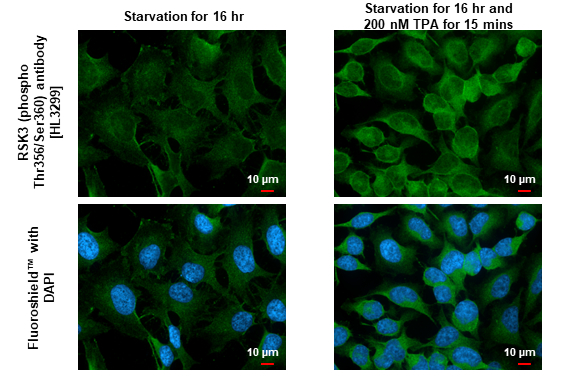RSK3 (phospho Thr356/Ser360) antibody [HL3299] detects RSK3 (phospho Thr356/Ser360) protein by immunofluorescent analysis. Sample: Mock and treated HeLa cells were fixed in 4% paraformaldehyde at RT for 15 min. Green: RSK3 (phospho Thr356/Ser360) stained by RSK3 (phospho Thr356/Ser360) antibody [HL3299] (GTX640988) diluted at 1:500. Blue: Fluoroshield with DAPI (GTX30920).