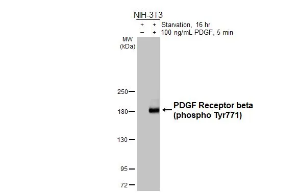 Untreated (–) and treated (+) NIH-3T3 whole cell extracts (30 μg) were separated by 5% SDS-PAGE, and the membrane was blotted with PDGF Receptor beta (phospho Tyr771) antibody [HL3300] (GTX640989) diluted at 1:1000. The HRP-conjugated anti-rabbit IgG antibody (GTX213110-01) was used to detect the primary antibody.