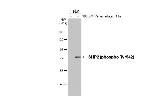 Untreated (–) and treated (+) HeLa whole cell extracts (30 μg) were separated by 7.5% SDS-PAGE, and the membrane was blotted with SHP2 (phospho Tyr542) antibody [HL3302] (GTX640991) diluted at 1:10000. The HRP-conjugated anti-rabbit IgG antibody (GTX213110-01) was used to detect the primary antibody.