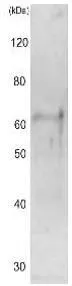 Identification of Cut15 protein in the crude extracts of S. pombe by Western blotting. Samples were prepared by alkali-lysis of the cells by TCA precipitation of protein. S. pombe lysate 10 ug. Antibody, 1,000 dilution. Cut15 protein was identified at~60 kDa position. Identification of Cut15 protein in the crude extracts of S. pombe by Western blotting. Samples were prepared by alkali-lysis of the cells by TCA precipitation of protein. S. pombe lysate 10 ug. Antibody, 1,000 dilution. Cut15 protein was identified at~60 kDa position.