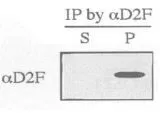 Immunoprecipitation of wild-type S. pombe extracts was performed using anti-dis2 antibody, D2F . Resulting immunoprecipitate (P) and supernatant(S) were immunoblotted by anti-dis2 antibody. (PMID: 8978689) Immunoprecipitation of wild-type S. pombe extracts was performed using anti-dis2 antibody, D2F . Resulting immunoprecipitate (P) and supernatant(S) were immunoblotted by anti-dis2 antibody. (PMID: 8978689)