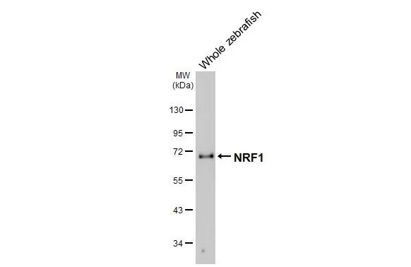 Whole zebrafish extract (30 μg) was separated by 10% SDS-PAGE, and the membrane was blotted with NRF1 antibody [HL3307] (GTX641069) diluted at 1:1000. The HRP-conjugated anti-rabbit IgG antibody (GTX213110-01) was used to detect the primary antibody.