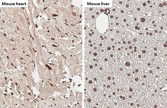 NRF1 antibody [HL3307] detects NRF1 protein by immunohistochemical analysis. Sample: Paraffin-embedded mouse tissues. NRF1 stained by NRF1 antibody [HL3307] (GTX641069) diluted at 1:200. Antigen Retrieval: Citrate buffer, pH 6.0, 15 min Corresponding RNA expression data for the same tissues are based on NCBI.