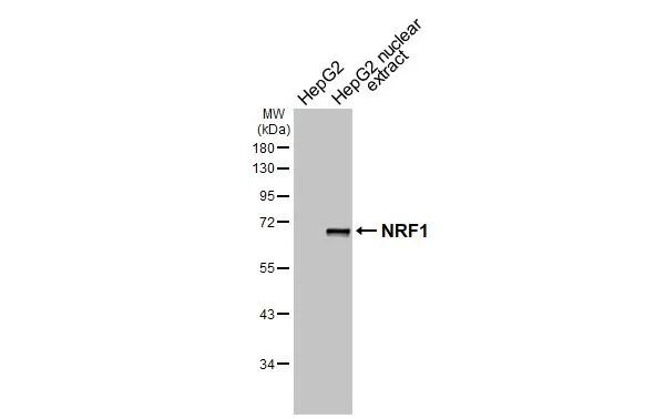 HepG2 whole cell and nuclear extracts (30 μg) were separated by 10% SDS-PAGE, and the membrane was blotted with NRF1 antibody [HL3307] (GTX641069) diluted at 1:1000. The HRP-conjugated anti-rabbit IgG antibody (GTX213110-01) was used to detect the primary antibody.