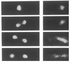 Localization of the dis3+ gene product by immunofluorescence microscopy. S. pombe cells were fixed and prepared for immunofluorescence microscopy with anti-dis3 antibodies. Left, DAPI stain for chromosomal DNA. Right, anti-Dis3 antibody stain (PMID : 1944266). Localization of the dis3+ gene product by immunofluorescence microscopy. S. pombe cells were fixed and prepared for immunofluorescence microscopy with anti-dis3 antibodies. Left, DAPI stain for chromosomal DNA. Right, anti-Dis3 antibody stain (PMID : 1944266).