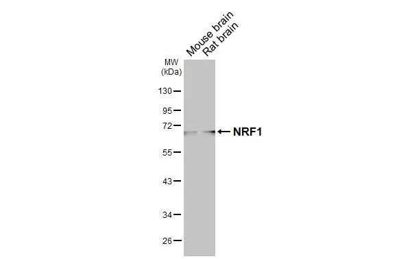 Various tissue extracts (50 μg) were separated by 10% SDS-PAGE, and the membrane was blotted with NRF1 antibody [HL3308] (GTX641070) diluted at 1:1000. The HRP-conjugated anti-rabbit IgG antibody (GTX213110-01) was used to detect the primary antibody.