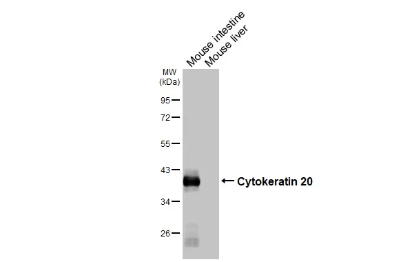 Various tissue extracts (50 μg) were separated by 10% SDS-PAGE, and the membrane was blotted with Cytokeratin 20 antibody [HL3309] (GTX641071) diluted at 1:20000. The HRP-conjugated anti-rabbit IgG antibody (GTX213110-01) was used to detect the primary antibody.