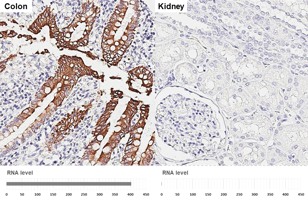 Cytokeratin 20 antibody [HL3309] detects Cytokeratin 20 protein by immunohistochemical analysis. Sample: Paraffin-embedded human tissues. Cytokeratin 20 stained by Cytokeratin 20 antibody [HL3309] (GTX641071) diluted at 1:750. Antigen Retrieval: Citrate buffer, pH 6.0, 15 min