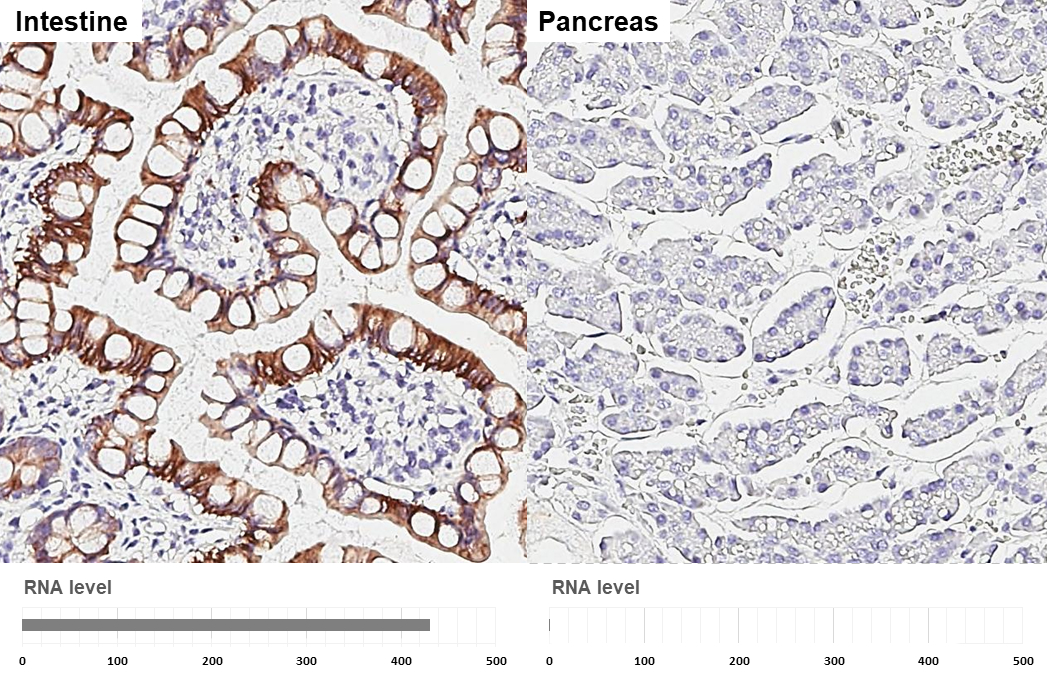 Cytokeratin 20 antibody [HL3309] detects Cytokeratin 20 protein by immunohistochemical analysis. Sample: Paraffin-embedded human tissues. Cytokeratin 20 stained by Cytokeratin 20 antibody [HL3309] (GTX641071) diluted at 1:750. Antigen Retrieval: Citrate buffer, pH 6.0, 15 min