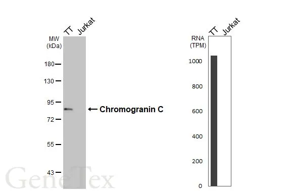 Various whole cell extracts (30 μg) were separated by 7.5% SDS-PAGE, and the membrane was blotted with Chromogranin C antibody [HL3311] (GTX641073) diluted at 1:1000. The HRP-conjugated anti-rabbit IgG antibody (GTX213110-01) was used to detect the primary antibody. Corresponding RNA expression data for the same cell lines are based on Human Protein Atlas program.