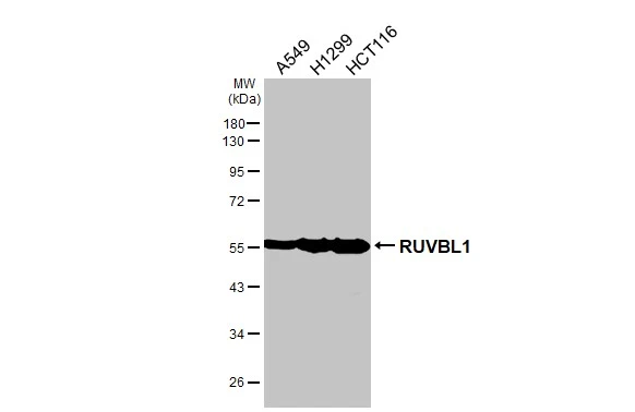 RUVBL1 antibody [HL3323]