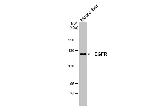 EGFR antibody [HL3325]
