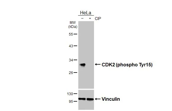 Untreated (–) and treated (+) HeLa whole cell extract (30 μg) were separated by 10% SDS-PAGE, and the membrane was blotted with CDK2 (phospho Tyr15) antibody [HL3327] (GTX641092) diluted at 1:2000. The HRP-conjugated anti-rabbit IgG antibody (GTX213110-01) was used to detect the primary antibody.