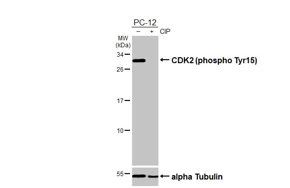Untreated (–) and treated (+) PC-12 whole cell extracts (30 μg) were separated by 12% SDS-PAGE, and the membrane was blotted with CDK2 (phospho Tyr15) antibody [HL3327] (GTX641092) diluted at 1:1000. The HRP-conjugated anti-rabbit IgG antibody (GTX213110-01) was used to detect the primary antibody.