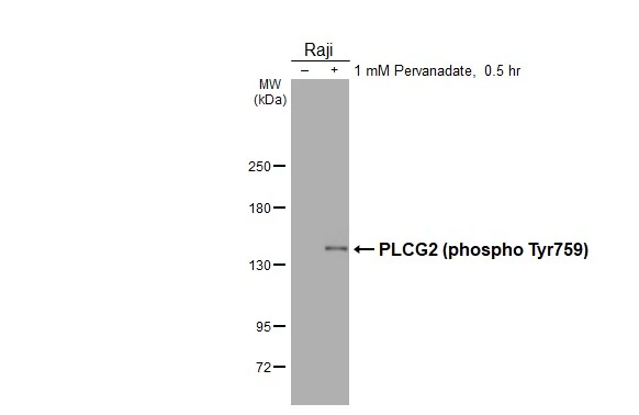 Untreated (–) and treated (+) Raji whole cell extract (30 μg) were separated by 5% SDS-PAGE, and the membrane was blotted with PLCG2 (phospho Tyr759) antibody [HL3329] (GTX641094) diluted at 1:5000. The HRP-conjugated anti-rabbit IgG antibody (GTX213110-01) was used to detect the primary antibody, and the signal was developed with Trident ECL plus-Enhanced.