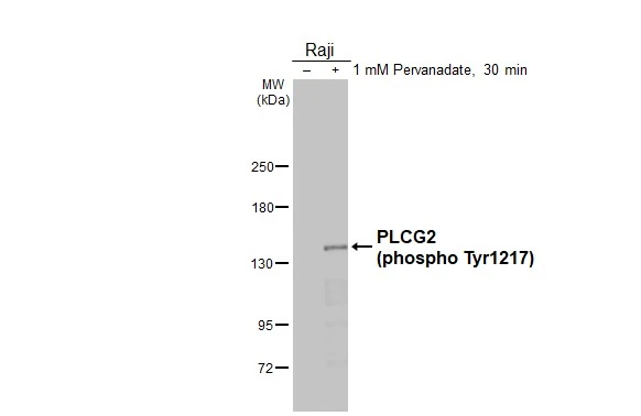 Untreated (–) and treated (+) Raji whole cell extracts (30 μg) were separated by 5% SDS-PAGE, and the membrane was blotted with PLCG2 (phospho Tyr1217) antibody [HL3332] (GTX641097) diluted at 1:15000. The HRP-conjugated anti-rabbit IgG antibody (GTX213110-01) was used to detect the primary antibody.