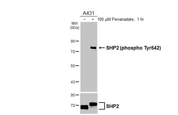 Untreated (–) and treated (+) A431 whole cell extract (30 μg) were separated by 7.5% SDS-PAGE, and the membranes were blotted with SHP2 (phospho Tyr542) antibody [HL3334] (GTX641099) diluted at 1:100000 and SHP2 antibody (GTX101062) diluted at 1:1000. The HRP-conjugated anti-rabbit IgG antibody (GTX213110-01) was used to detect the primary antibody.
