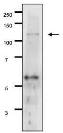Detection of Gal11p by Western blotting using the Gal11p antibody in the whole cell extract of S. cerevisiae The antiserum was used at 1/500 dilution. 7.5% gradient gel was used and wet system was used for blotting. Detection of Gal11p by Western blotting using the Gal11p antibody in the whole cell extract of S. cerevisiae The antiserum was used at 1/500 dilution. 7.5% gradient gel was used and wet system was used for blotting.