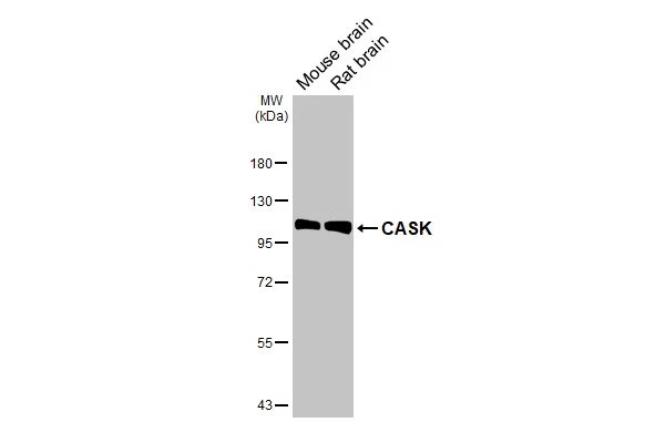 Various tissue extracts (50 μg) were separated by 7.5% SDS-PAGE, and the membrane was blotted with CASK antibody [GT27] (GTX641106) diluted at 1:1000. The HRP-conjugated anti-mouse IgG antibody (GTX213111-01) was used to detect the primary antibody.
