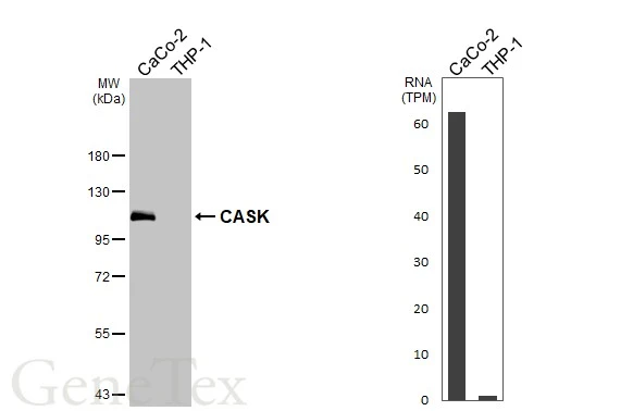 Various whole cell extracts (30 μg) were separated by 7.5% SDS-PAGE, and the membrane was blotted with CASK antibody [GT27] (GTX641106) diluted at 1:1000. The HRP-conjugated anti-mouse IgG antibody (GTX213111-01) was used to detect the primary antibody. Corresponding RNA expression data for the same cell lines are based on Human Protein Atlas program.