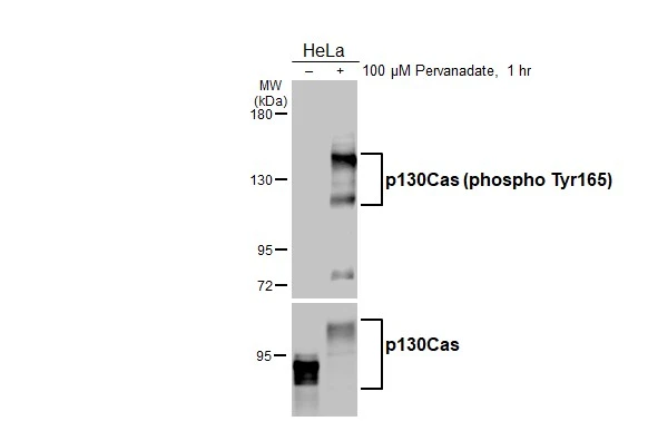 Untreated (–) and treated (+) HeLa whole cell extracts (30 μg) were separated by 5% SDS-PAGE, and the membrane was blotted with p130Cas (phospho Tyr165) antibody [HL3339] (GTX641111) diluted at 1:20000. The HRP-conjugated anti-rabbit IgG antibody (GTX213110-01) was used to detect the primary antibody.