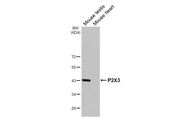 Various tissue extracts (50 μg) were separated by 10% SDS-PAGE, and the membrane was blotted with P2X3 antibody [HL3347] (GTX641119) diluted at 1:1000. The HRP-conjugated anti-rabbit IgG antibody (GTX213110-01) was used to detect the primary antibody.