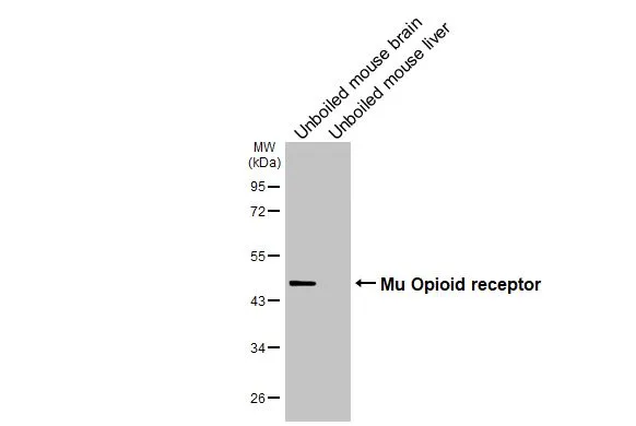 Unboiled various tissue extracts (50 μg) were separated by 10% SDS-PAGE, and the membrane was blotted with Mu Opioid receptor antibody [HL3348] (GTX641120) diluted at 1:500. The HRP-conjugated anti-rabbit IgG antibody (GTX213110-01) was used to detect the primary antibody.