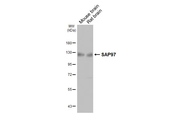 Various tissue extracts (50 μg) were separated by 7.5% SDS-PAGE, and the membrane was blotted with SAP97 antibody (GTX641123) diluted at 1:500. The HRP-conjugated anti-mouse IgG antibody (GTX213111-01) was used to detect the primary antibody.