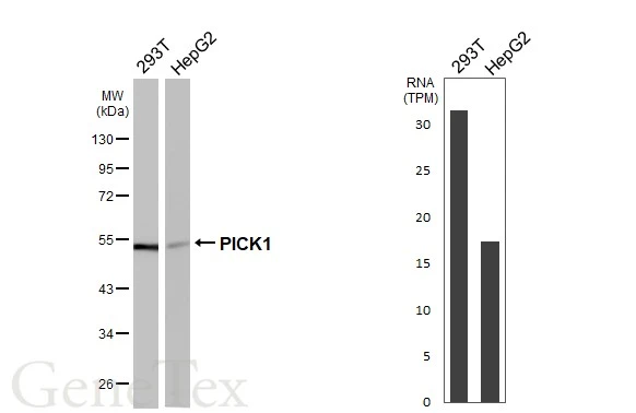 Various whole cell extracts (30 μg) were separated by 10% SDS-PAGE, and the membrane was blotted with PICK1 antibody [GT32] (GTX641124) diluted at 1:1000. The HRP-conjugated anti-mouse IgG antibody (GTX213111-01) was used to detect the primary antibody. Corresponding RNA expression data for the same cell lines are based on Human Protein Atlas program.