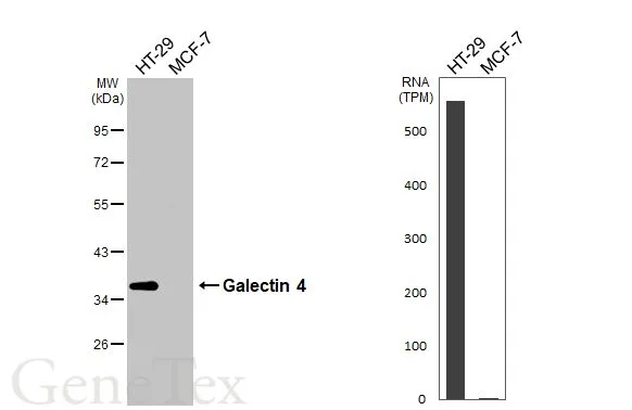Various whole cell extracts (30 μg) were separated by 10% SDS-PAGE, and the membrane was blotted with Galectin 4 antibody [HL3350] (GTX641127) diluted at 1:1000. The HRP-conjugated anti-rabbit IgG antibody (GTX213110-01) was used to detect the primary antibody. Corresponding RNA expression data for the same cell lines are based on Human Protein Atlas program.