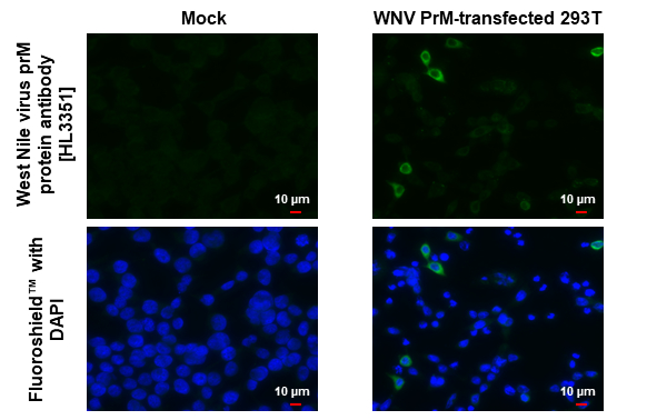 West Nile virus prM protein antibody [HL3351] detects West Nile virus prM protein protein by immunofluorescent analysis. Sample: Mock and transfected 293T cells were fixed in ice-cold MeOH for 5 min. Green: West Nile virus prM protein stained by West Nile virus prM protein antibody [HL3351] (GTX641128) diluted at 1:500. Blue: Fluoroshield with DAPI (GTX30920).
