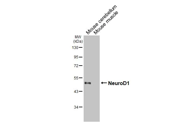 NeuroD1 antibody [HL3356]