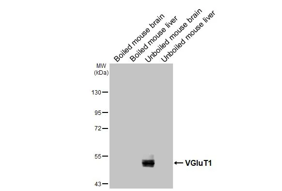 Boiled and unboiled various tissue extracts (50 μg) were separated by 7.5% SDS-PAGE, and the membrane was blotted with VGluT1 antibody [GT34] (GTX641142) diluted at 1:1000. The HRP-conjugated anti-mouse IgG antibody (GTX213111-01) was used to detect the primary antibody.