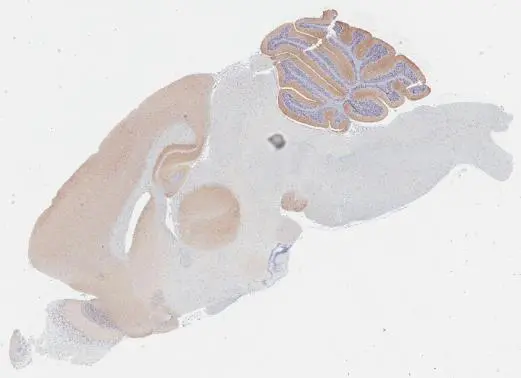 VGluT1 antibody [GT34] detects VGluT1 protein by immunohistochemical analysis. Sample: Paraffin-embedded mouse brain. VGluT1 stained by VGluT1 antibody [GT34] (GTX641142) diluted at 1:100. Antigen Retrieval: Citrate buffer, pH 6.0, 15 min