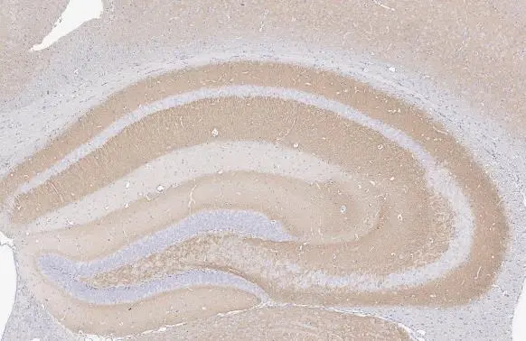 VGluT1 antibody [GT34] detects VGluT1 protein by immunohistochemical analysis. Sample: Paraffin-embedded mouse hippocampus. VGluT1 stained by VGluT1 antibody [GT34] (GTX641142) diluted at 1:100. Antigen Retrieval: Citrate buffer, pH 6.0, 15 min