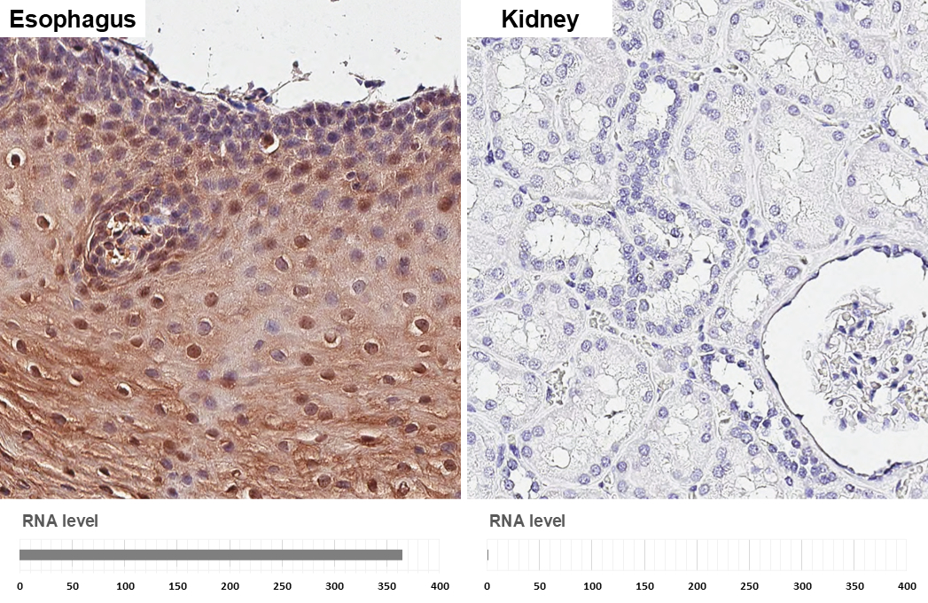 IL1 Receptor antagonist antibody [HL3366] detects IL1 Receptor antagonist protein by immunohistochemical analysis. Sample: Paraffin-embedded human tissues. IL1 Receptor antagonist stained by IL1 Receptor antagonist antibody [HL3366] (GTX641186) diluted at 1:2500. Antigen Retrieval: Tris-EDTA buffer, pH 9.0, 15 min