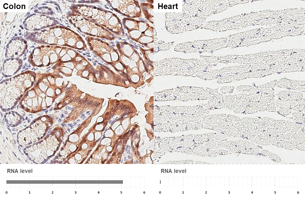 IL1 Receptor antagonist antibody [HL3369] detects IL1 Receptor antagonist protein by immunohistochemical analysis. Sample: Paraffin-embedded mouse tissues. IL1 Receptor antagonist stained by IL1 Receptor antagonist antibody [HL3369] (GTX641189) diluted at 1:200. Antigen Retrieval: Tris-EDTA buffer, pH 9.0, 15 min Corresponding RNA expression data for the same tissues are based on NCBI.