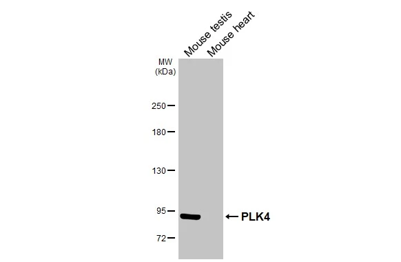 Various tissue extracts (50 μg) were separated by 5% SDS-PAGE, and the membrane was blotted with PLK4 antibody [HL3371] (GTX641191) diluted at 1:1000. The HRP-conjugated anti-rabbit IgG antibody (GTX213110-01) was used to detect the primary antibody.