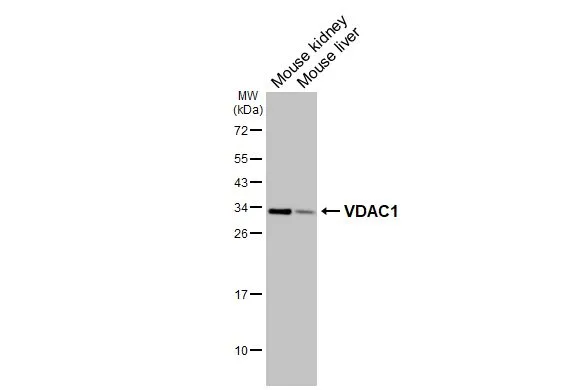 Various tissue extracts (50 μg) were separated by 12% SDS-PAGE, and the membrane was blotted with VDAC1 antibody [HL3373] (GTX641193) diluted at 1:1000. The HRP-conjugated anti-rabbit IgG antibody (GTX213110-01) was used to detect the primary antibody.