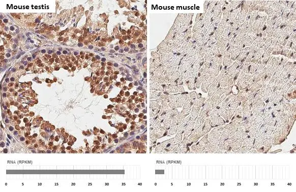 Suppressor of Fused antibody [HL3374] detects Suppressor of Fused protein by immunohistochemical analysis. Sample: Paraffin-embedded mouse tissues. Suppressor of Fused stained by Suppressor of Fused antibody [HL3374] (GTX641194) diluted at 1:100. Antigen Retrieval: Citrate buffer, pH 6.0, 15 min Corresponding RNA expression data for the same tissues are based on NCBI.