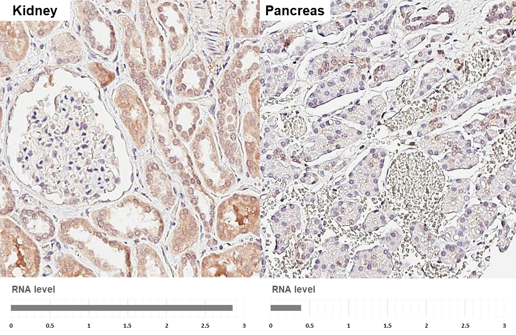 Suppressor of Fused antibody [HL3374] detects Suppressor of Fused protein by immunohistochemical analysis. Sample: Paraffin-embedded human tissues. Suppressor of Fused stained by Suppressor of Fused antibody [HL3374] (GTX641194) diluted at 1:250. Antigen Retrieval: Citrate buffer, pH 6.0, 15 min