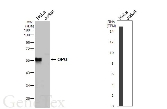 Various whole cell extracts (30 μg) were separated by 10% SDS-PAGE, and the membrane was blotted with OPG antibody [HL3377] (GTX641197) diluted at 1:1000. The HRP-conjugated anti-rabbit IgG antibody (GTX213110-01) was used to detect the primary antibody. Corresponding RNA expression data for the same cell lines are based on Human Protein Atlas program.