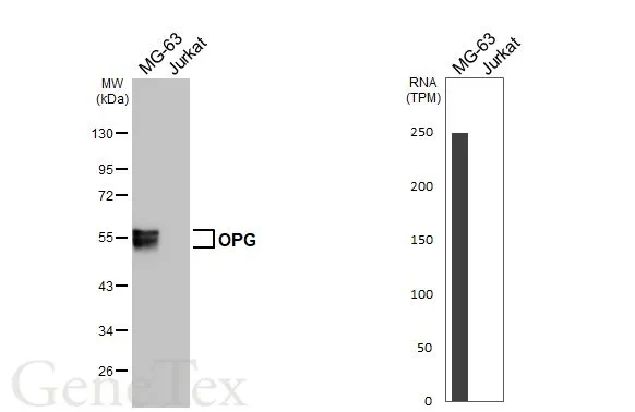 Various whole cell extracts (30 μg) were separated by 10% SDS-PAGE, and the membrane was blotted with OPG antibody [HL3377] (GTX641197) diluted at 1:1000. The HRP-conjugated anti-rabbit IgG antibody (GTX213110-01) was used to detect the primary antibody. Corresponding RNA expression data for the same cell lines are based on Human Protein Atlas program.