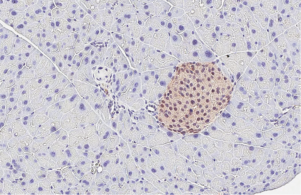 PGP9.5 antibody [HL3391] detects PGP9.5 protein by immunohistochemical analysis. Sample: Paraffin-embedded mouse pancreas. PGP9.5 stained by PGP9.5 antibody [HL3391] (GTX641211) diluted at 1:1000. Antigen Retrieval: Citrate buffer, pH 6.0, 15 min