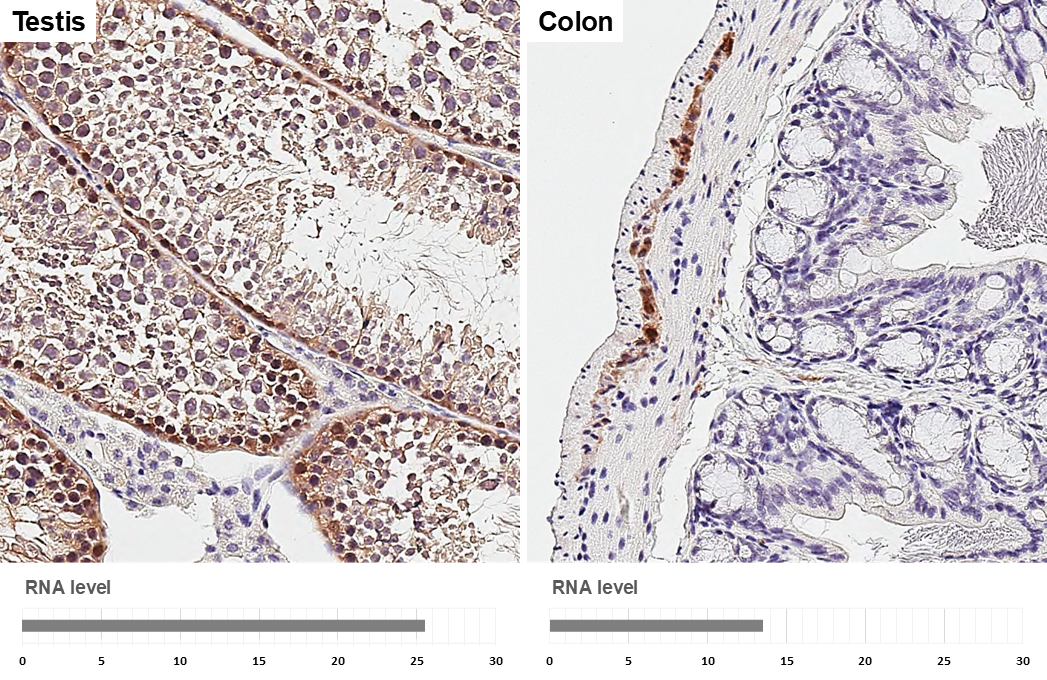 PGP9.5 antibody [HL3391] detects PGP9.5 protein by immunohistochemical analysis. Sample: Paraffin-embedded mouse tissues. PGP9.5 stained by PGP9.5 antibody [HL3391] (GTX641211) diluted at 1:1000. Antigen Retrieval: Citrate buffer, pH 6.0, 15 min