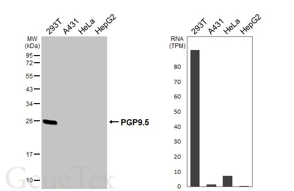 Various whole cell extracts (30 μg) were separated by 12% SDS-PAGE, and the membrane was blotted with PGP9.5 antibody [HL3391] (GTX641211) diluted at 1:1000. The HRP-conjugated anti-rabbit IgG antibody (GTX213110-01) was used to detect the primary antibody. Corresponding RNA expression data for the same cell lines are based on Human Protein Atlas program.