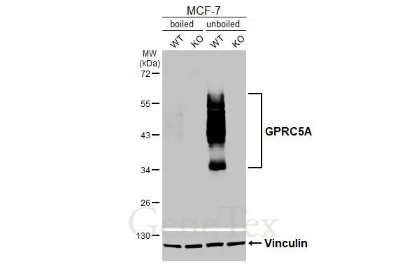 Boiled and unboiled wild-type (WT) and GPRC5A knockout (KO) MCF-7 cell extracts (30 μg) were separated by 10% SDS-PAGE, and the membrane was blotted with GPRC5A antibody [HL3393] (GTX641213) diluted at 1:1000. The HRP-conjugated anti-rabbit IgG antibody (GTX213110-01) was used to detect the primary antibody.
