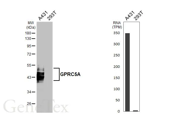 Various whole cell extracts (30 μg) were separated by 10% SDS-PAGE, and the membrane was blotted with GPRC5A antibody [HL3393] (GTX641213) diluted at 1:1000. The HRP-conjugated anti-rabbit IgG antibody (GTX213110-01) was used to detect the primary antibody. Corresponding RNA expression data for the same cell lines are based on Human Protein Atlas program.